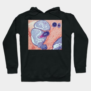 Dermoid ovarian cyst, light micrograph (C019/9256) Hoodie